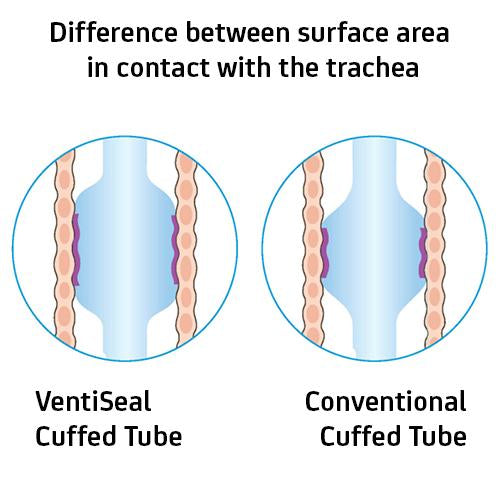 VentiSeal ET Tube - Cuffed