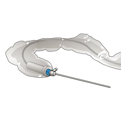 Sterile Tube/ Cable Cover 8 x 125cm (20pk)