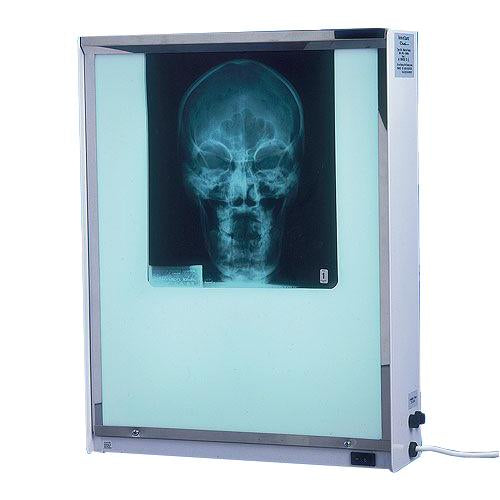 X-Ray Viewer Fluorescent Illumination Single Screen