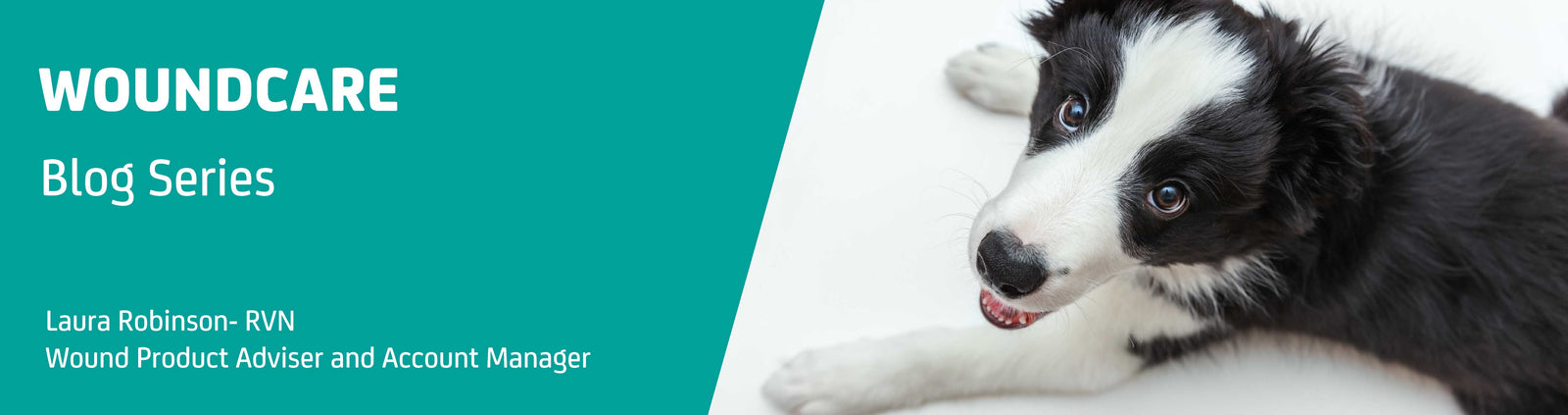 May Wound Blog – An overview of Burns