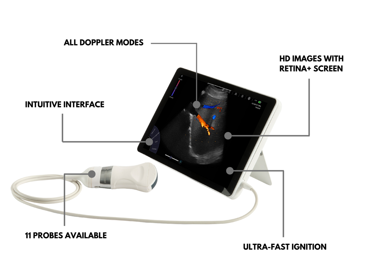 T-Lite PRO Ultrasound Scanner & Probes