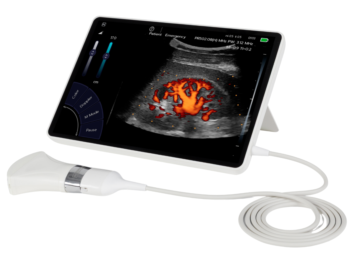 T-Lite PRO Ultrasound Scanner & Probes