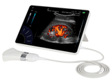 T-Lite PRO Ultrasound Scanner & Probes